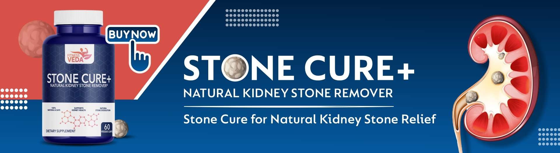 Stone Cure 1920x527